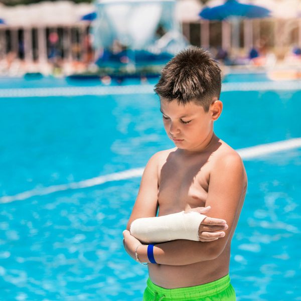 Boy in arm cast next to pool
